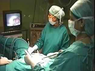 laparoscopy